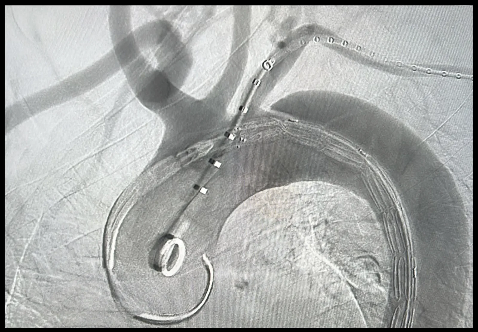 Cirugía Vascular y Endovascular